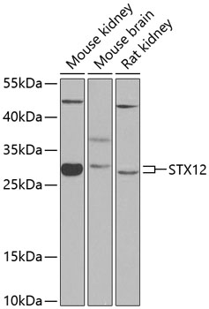 STX12 Rabbit Polyclonal Antibody