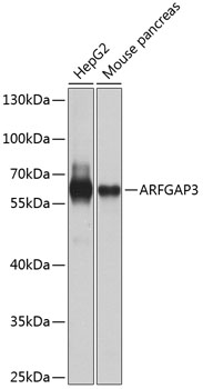 ARFGAP3 Rabbit Polyclonal Antibody