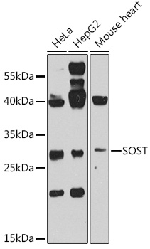 SOST Rabbit Polyclonal Antibody