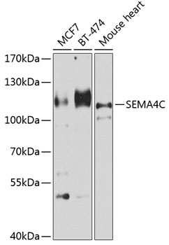 SEMA4C Rabbit Polyclonal Antibody
