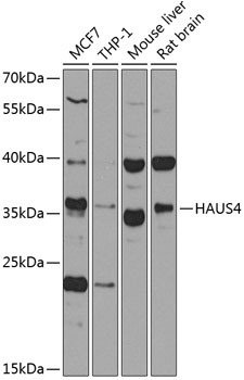 HAUS4 Rabbit Polyclonal Antibody