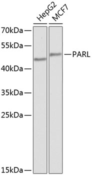 PARL Rabbit Polyclonal Antibody