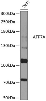 ATP7A Rabbit Polyclonal Antibody