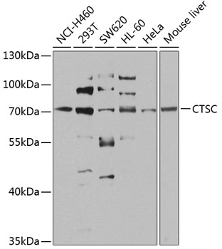 CTSC Rabbit Polyclonal Antibody