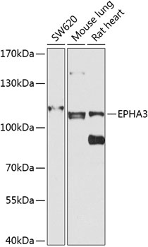 EPHA3 Rabbit Polyclonal Antibody