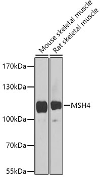 MSH4 Rabbit Polyclonal Antibody