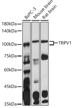 TRPV1 Rabbit Polyclonal Antibody