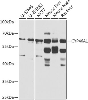 CYP46A1 Rabbit Polyclonal Antibody