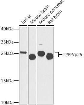 TPPP Rabbit Polyclonal Antibody