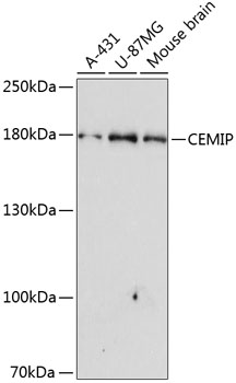 CEMIP Rabbit Polyclonal Antibody