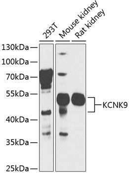 KCNK9 Rabbit Polyclonal Antibody
