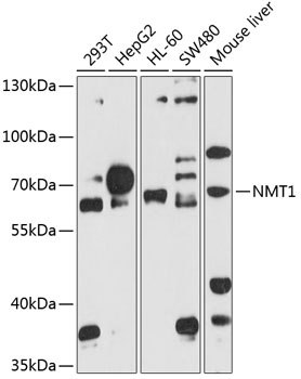 NMT1 Rabbit Polyclonal Antibody