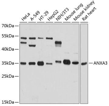 ANXA3 Rabbit Polyclonal Antibody
