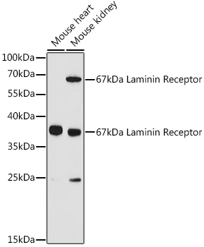 RPSA Rabbit Polyclonal Antibody