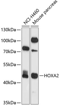 HOXA2 Rabbit Polyclonal Antibody