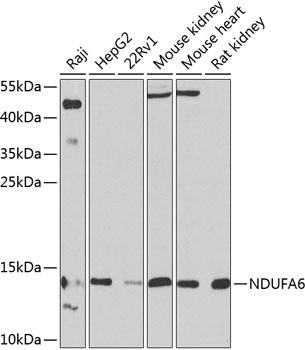 NDUFA6 Rabbit Polyclonal Antibody