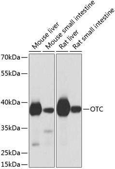 OTC Rabbit Polyclonal Antibody