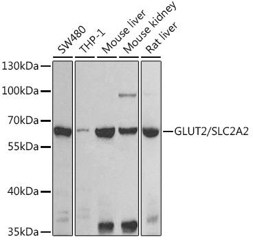 SLC2A2 Rabbit Polyclonal Antibody