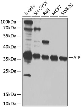 AIP Rabbit Polyclonal Antibody