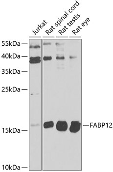 FABP12 Rabbit Polyclonal Antibody