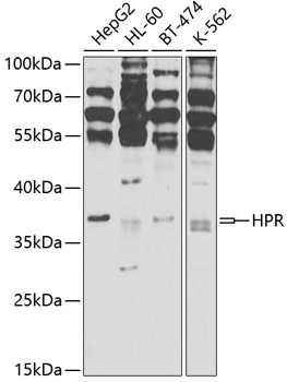 HPR Rabbit Polyclonal Antibody