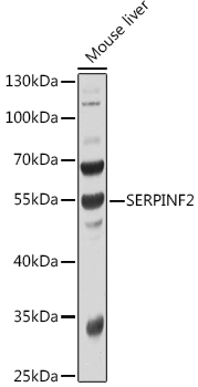 SERPINF2 Rabbit Polyclonal Antibody