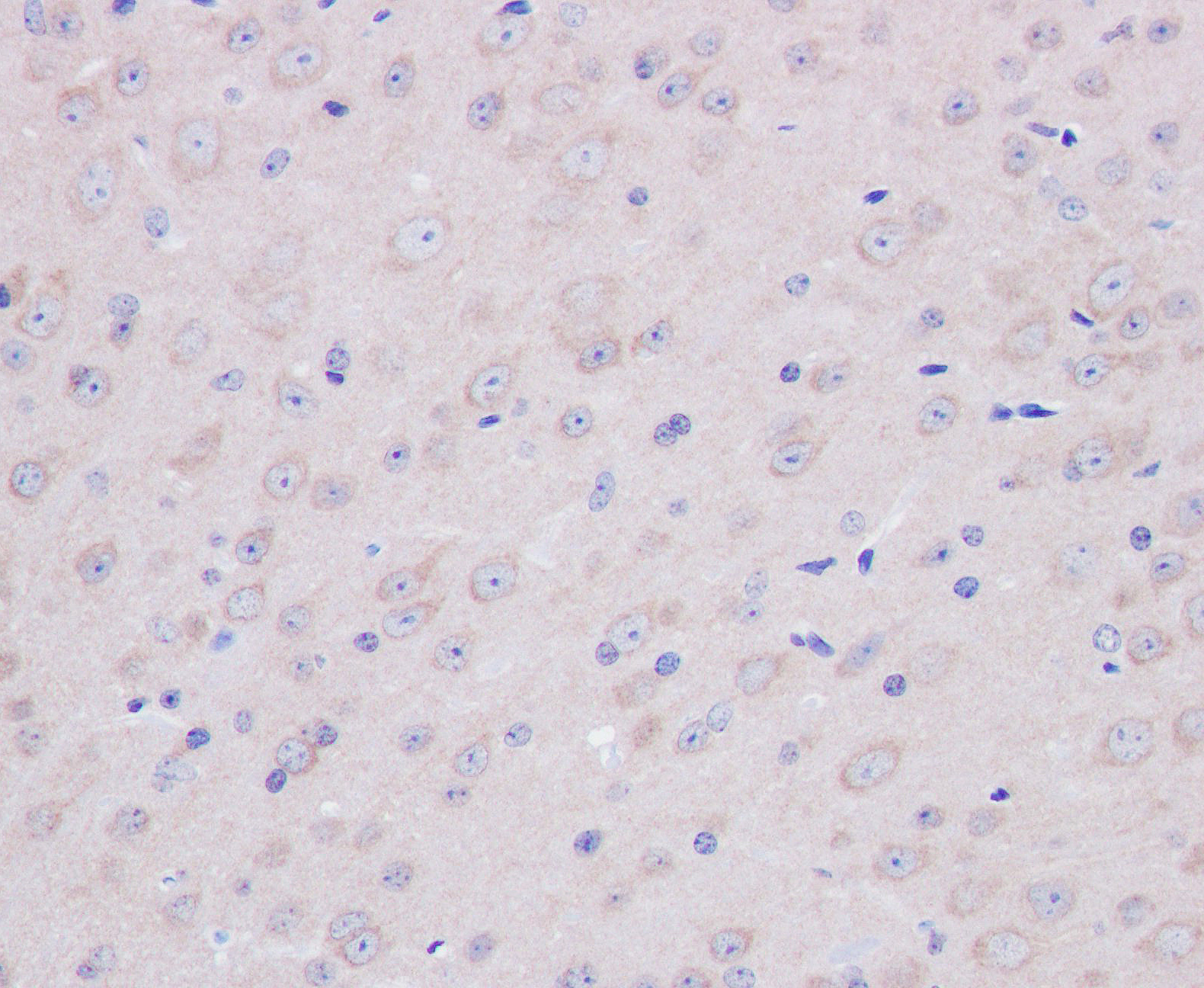 Recombinant Tau(Phospho-Thr217) Rabbit mAb(G122)
