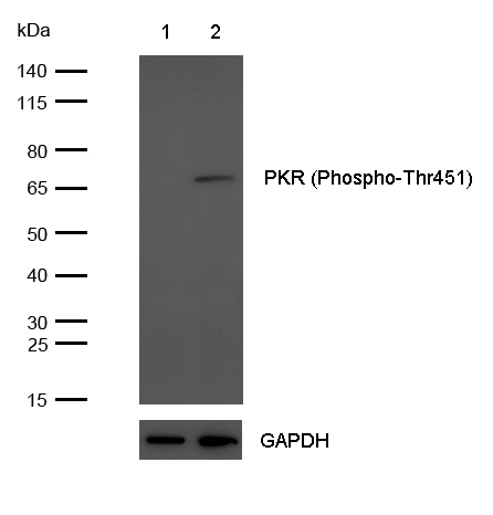 PKR (Phospho-Thr451) Antibody