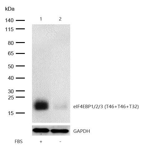 eIF4EBP1/2/3 (Phospho-Thr32/T46) Antibody