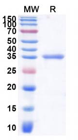 Recombinant Human G1/S-specific cyclin-D1(CCND1)