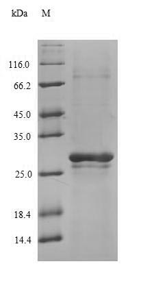 Recombinant Human N(4)-(beta-N-acetylglucosaminyl)-L-asparaginase(AGA),partial