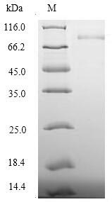 Recombinant Human Desmoglein-3(DSG3) ,partial