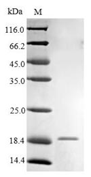 Recombinant Human High affinity immunoglobulin epsilon receptor subunit gamma(FCER1G)