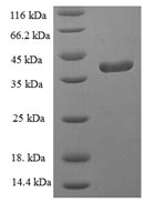 Recombinant Human Glutathione peroxidase 1(GPX1)