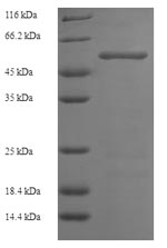 Recombinant Human Hexokinase-1(HK1),partial