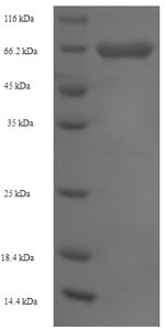 Recombinant Human Hexokinase-1(HK1),partial