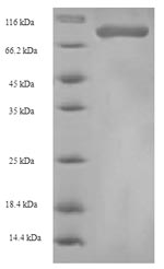 Recombinant Human Heterogeneous nuclear ribonucleoprotein L(HNRNPL)