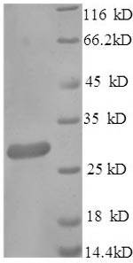 Recombinant Human Heat shock protein HSP 90-alpha(HSP90AA1),partial