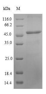 Recombinant Human Antigen KI-67(MKI67),partial