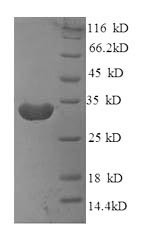 Recombinant Mouse B-lymphocyte antigen CD20(Ms4a1) ,partial