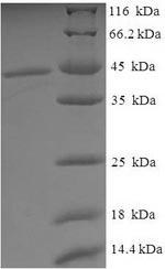 Recombinant Human Tissue-type plasminogen activator(PLAT),partial
