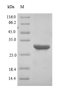 Recombinant Epstein-Barr virus Small capsomere-interacting protein(SCP),partial