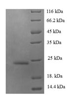 Recombinant Human C-C motif chemokine 14(CCL14)