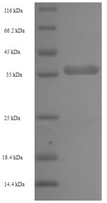 Recombinant Pan troglodytes Lymphotoxin-beta(LTB),partial