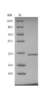 Recombinant Human Metalloproteinase inhibitor 4(TIMP4)