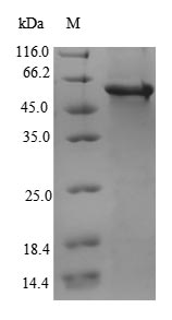 Recombinant Human L-2-hydroxyglutarate dehydrogenase, mitochondrial(L2HGDH)