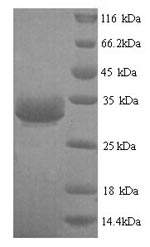 Recombinant Human Ezrin protein(ESR2),partial