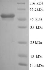 Recombinant Mouse Glial fibrillary acidic protein(GFAP)