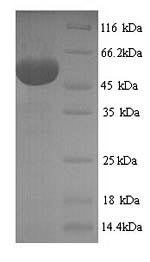 Recombinant Human Hexokinase-1(HK1) ,partial