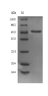 Recombinant Rat Alpha-1-antiproteinase(Serpina1)